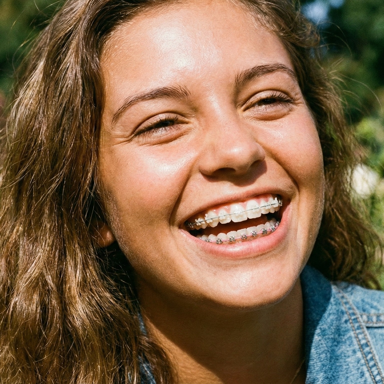 Traditional metal and ceramic braces for teeth straightening